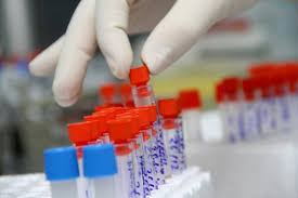 Điều kiện của phòng xét nghiệm HIV bằng kỹ thuật đơn giản